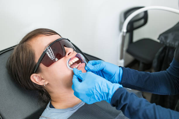 Best Knocked-Out Tooth (Avulsed Tooth) Treatment in Gladewater, TX